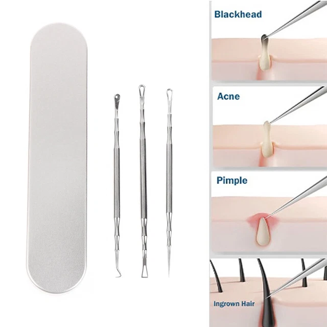 Pinzetta rimozione punti neri ultra fine salone di bellezza viso strumenti per la cura della pelle del viso RODE