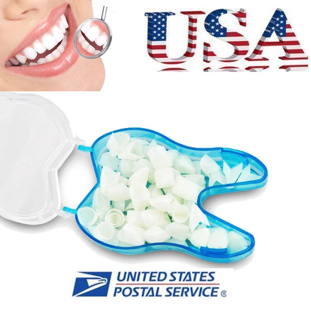 60pcs Dental Temporary Crown Material For Anterior Front Teeth Porcelain System