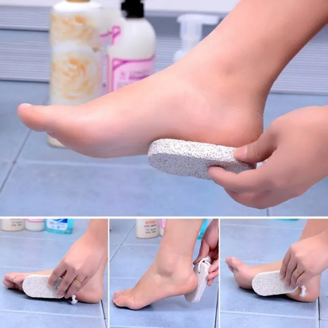 2pk Natural Pumice Stone For Feet | Hard Dead Skin Callus Remover Exfoliate Foot