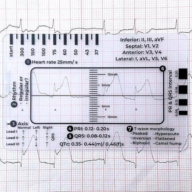 EKG ECG 7 Step Ruler Card For ECG/EKG Interpretation,Portable ECG EKG ...
