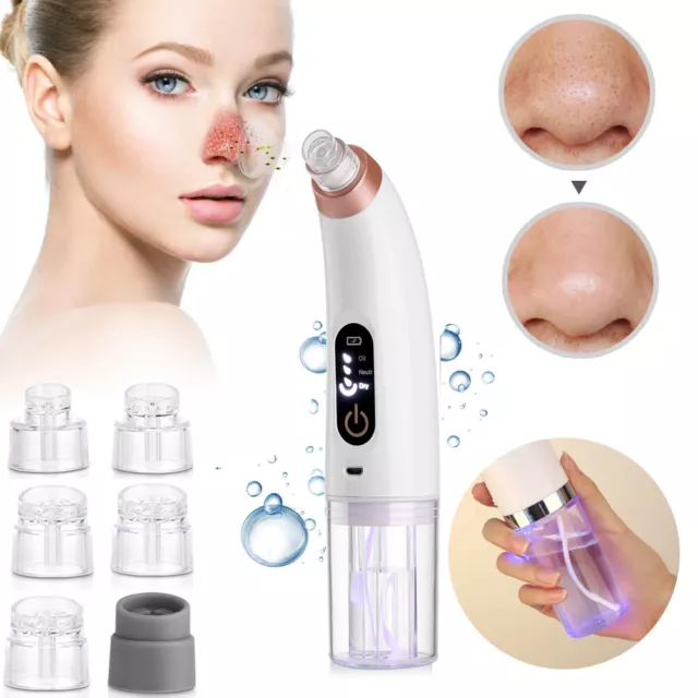 Elektrisch Mitesserentferner Hydrafacial-Expert, Porenreiniger, Vakuumsauger Set