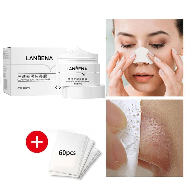 LANBENA Rimuovi Punti Neri Crema Naso Viso Maschera Pianta Donna Acne FANTASTICO Poro Q7Y7