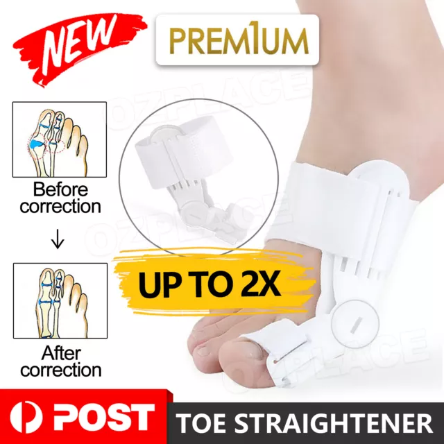 Bunion Corrector Hammer Toe Splint Straightener Orthopedic Brace Valgus Hallux