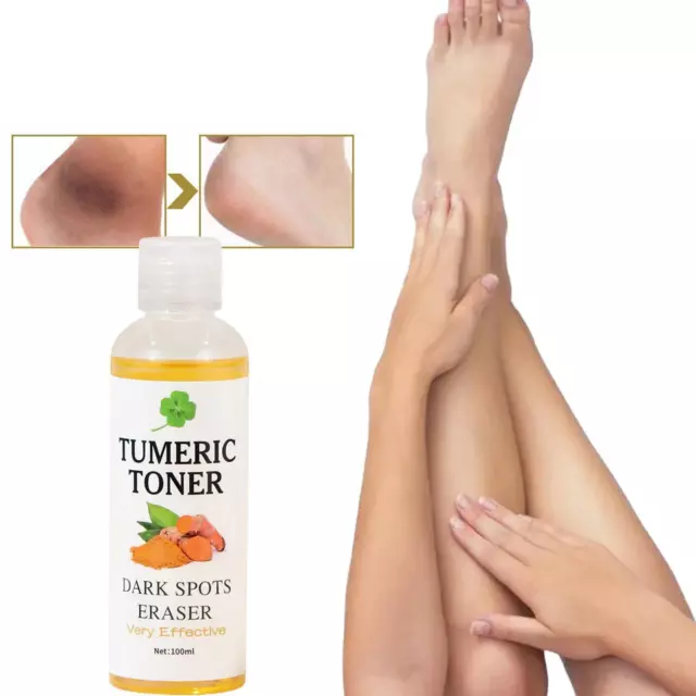 Turmeric Toner Dark Spots Facial Toner Spot Eraser Dark Spotless BEST Skin