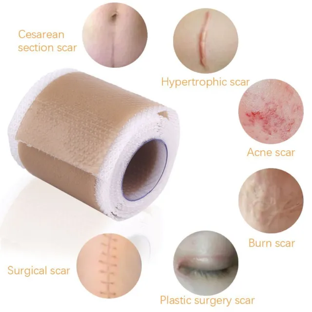 Easy to use Silicone Gel Tape Removal Scar Tape Skin Repair Tools Therapy Patch