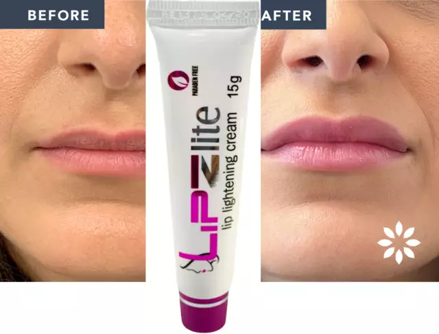 Lipzlite Crème éclaircissante pour les lèvres foncées qui deviennent roses...