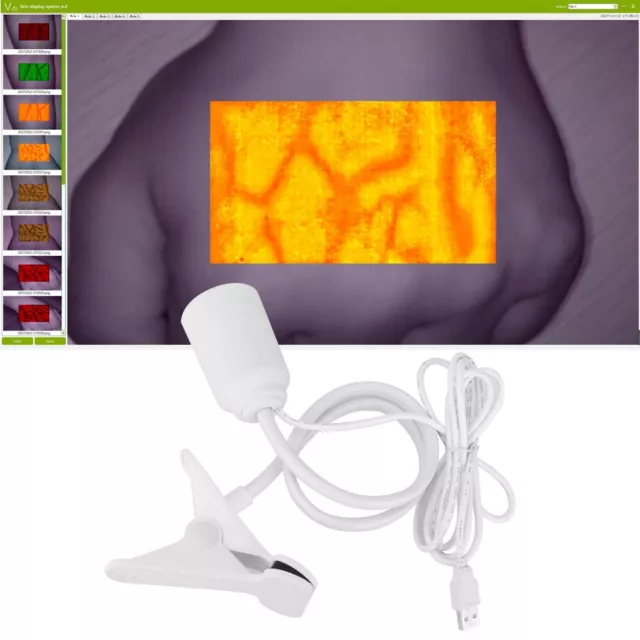 Infrared Vein Viewer Transilluminator LED Medical Vein Finder for Kids Adult A