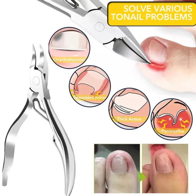 Nuovo Strumento Professionale Per Rimuovere La Manicure Per Cuticole E A
