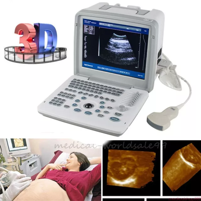 Portable Digital Ultrasound Scanner Machine Obstetric Ultrasound Convex Probe 3D