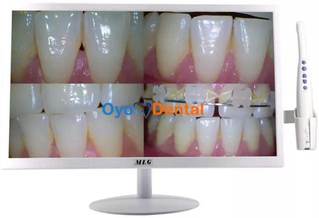 Dental Intraoral Camera 19 Inch LCD Monitor with 5G Wireless Wifi 8 Mega Pixels