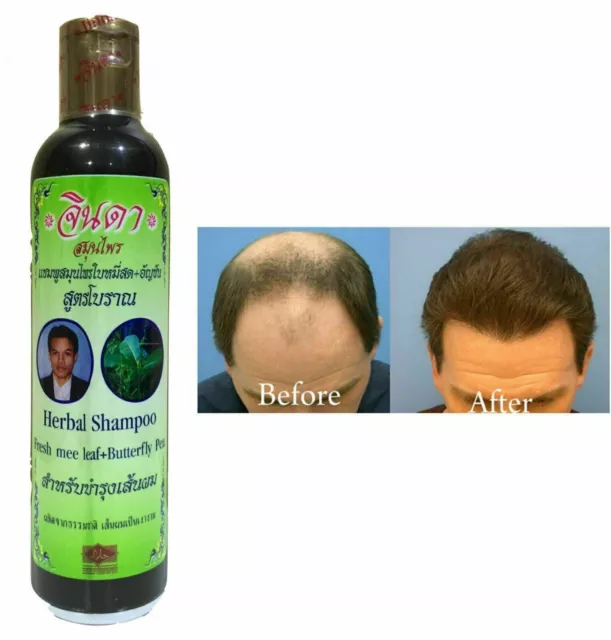 La formule ancienne Jinda Herbal Fresh Mee aide la croissance des cheveux...