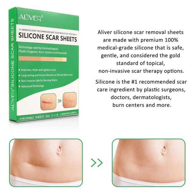 Strisce gel di silicone Aliver patch riparazione Scar Away Away W4F8 W8J8 M1J9 U1M5