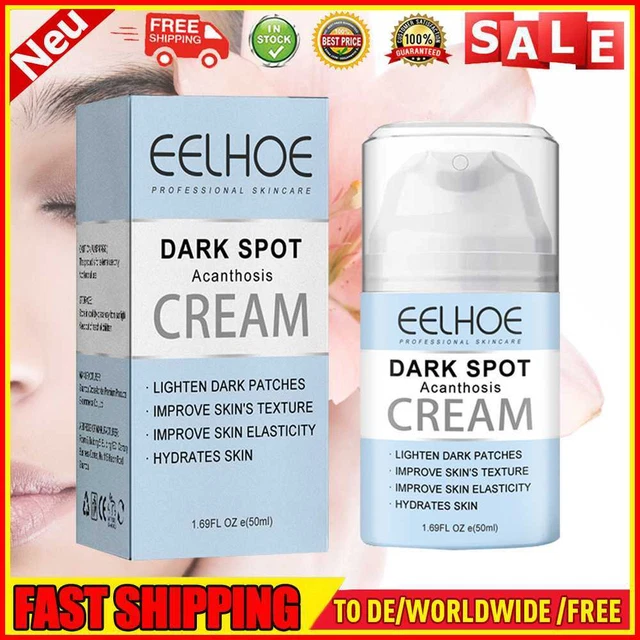 Creme corpo durevoli acanthosis nigricans sbiadiscono macchie scure 50 ml per tutta la cura della pelle