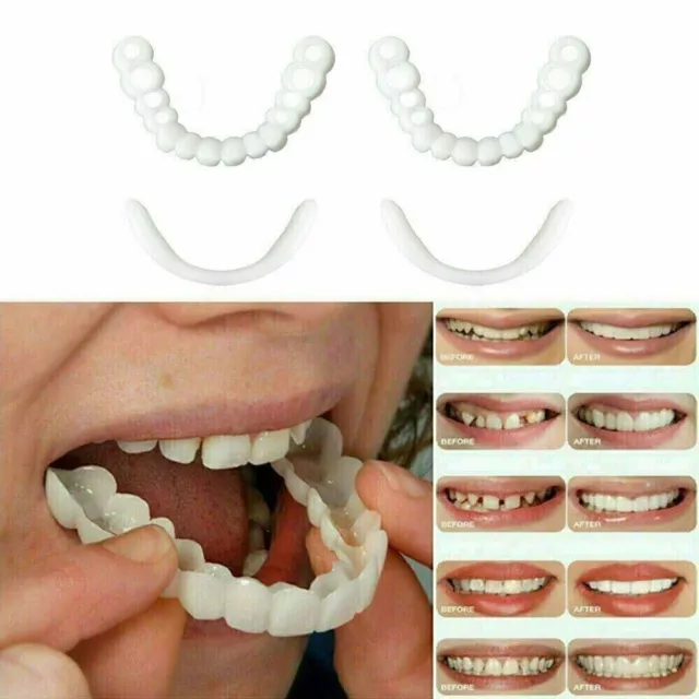 Snap On False Teeth Upper + Lower Dental Veneers Dentures Tooth Cover Set Hot uk