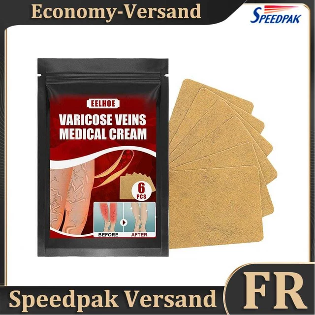 Effective Varicose Vein Relief Patch Body Leg Vasculitis Phlebitis Spider Hot