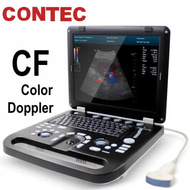 Advanced Portable Color Doppler laptop Digital Ultrasound Scanner machine CONTEC