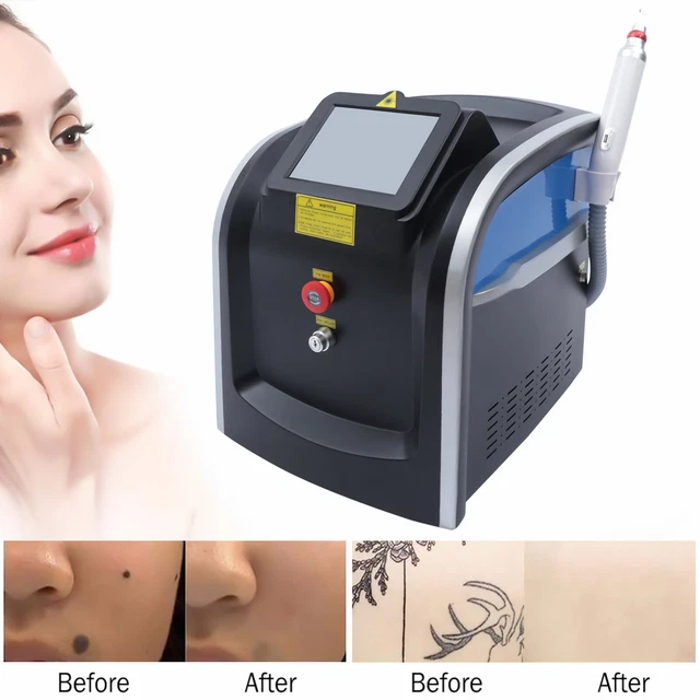 Láser de picosegundos para eliminación de tatuajes eliminación de PMU cuatro longitudes de onda