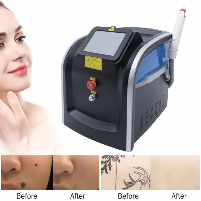 Máquina láser Picosegundo eliminación de pigmentos de tatuaje rejuvenecimiento de la piel blanqueamiento DHL