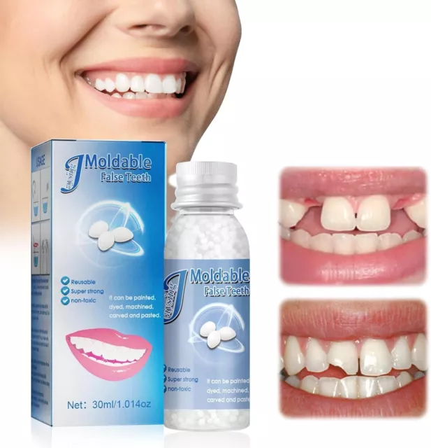 Kit Otturazione Denti, 30Ml Cemento per Denti, Granuli Di Riparazione Dei Denti