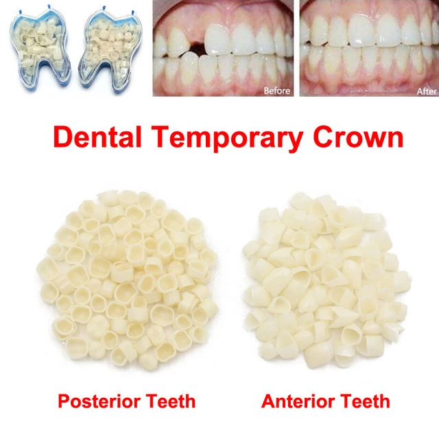 DENTAL RESIN MOLAR Anterior Posterior Temporary Crown Porcelain Teeth