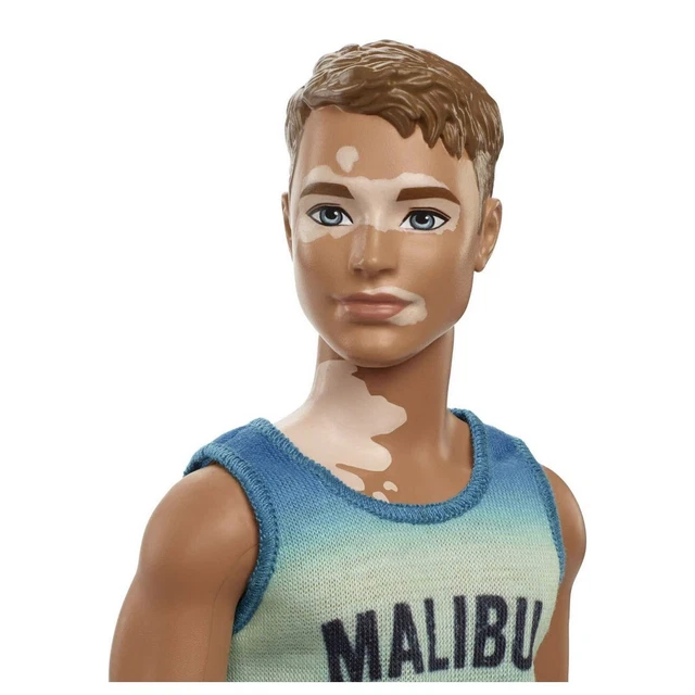 BARBIE FASHIONISTAS 192 KEN DOLL Vitiligo Skin Condition Awareness