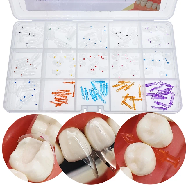 DENTAL CLEAR MATRIX Anterior Posterior Restorative BT Bow Matrices Fit ...
