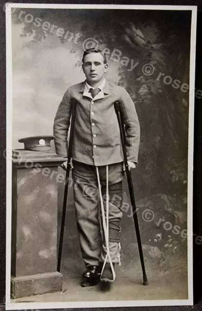 WW1 Wounded Bedfordshire Rgt  with Medical platform Shoe - Real Photo Postcard