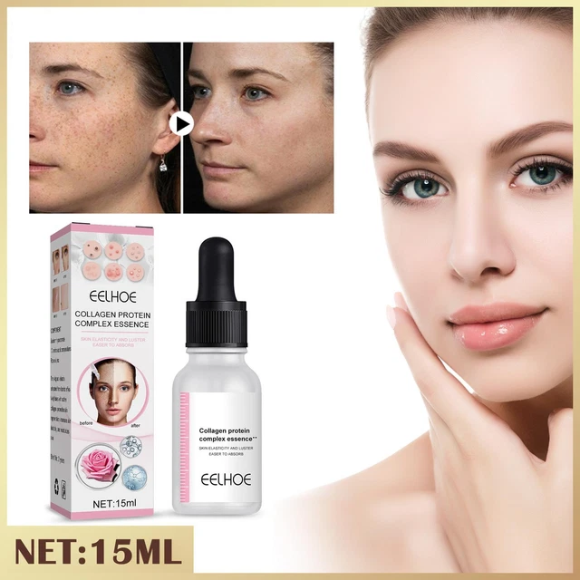 Suero de colágeno placentario oveja 15 ml V