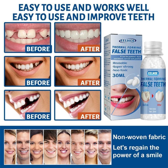 Tooth Repair Granules Temporary Kit Fitting Beads Reusable Moldable Teeth T8V9
