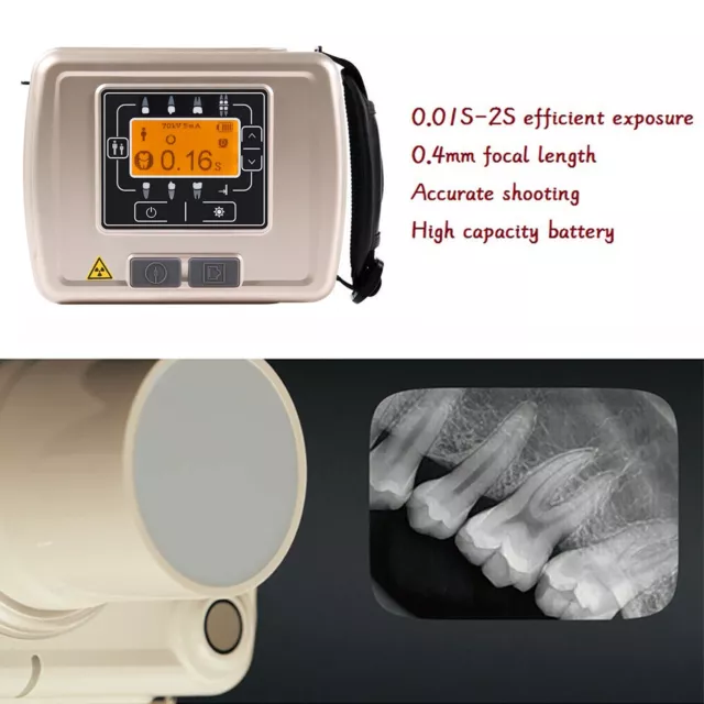 Handheld Dental X-ray Unit High Frequency Portable X-ray Machine with LCD Screen