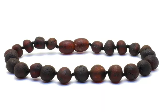 Raw Cherry Baltic Amber Bracelet/Anklet-Beads Knotted Adult sizes 14-22cm