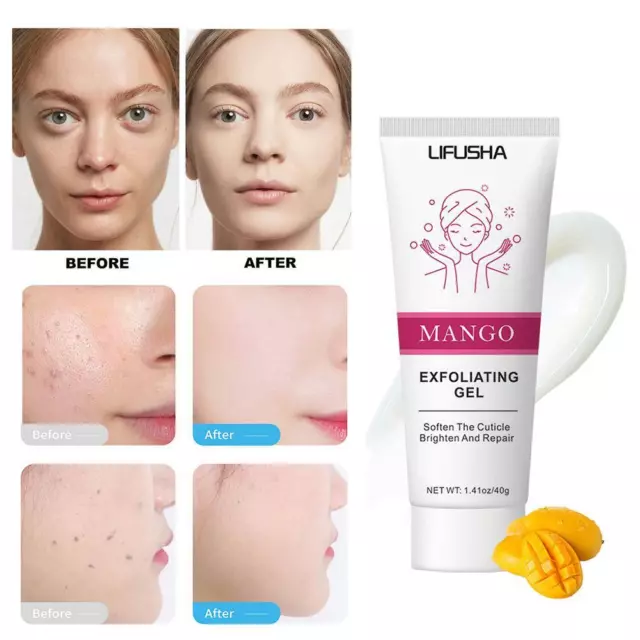 Mango Exfoliating Gel Cream Facial Scrub Exfoliating Cream✨e Face L4Z6