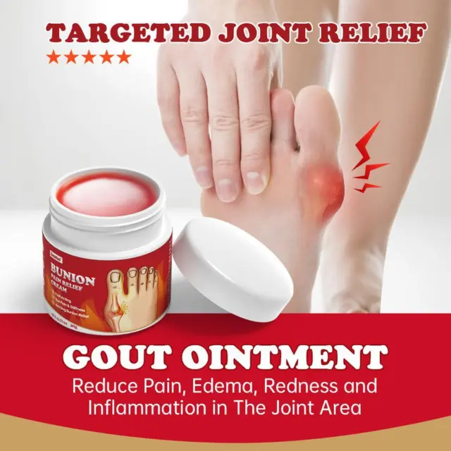 Urigone Healing Ointment For Gout, Bunion Pain ReliefCream、 C8Q2 A