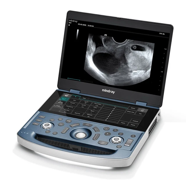 MINDRAY MX7 Ultrasound Machine, Standard Config. New