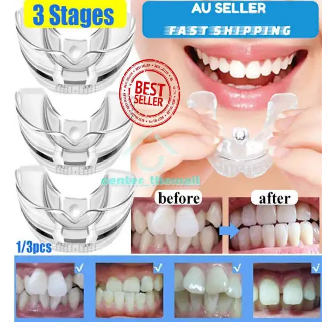 3 Stages Dental Orthodontic Teeth Corrector Braces Tooth Retainer Straighten AL