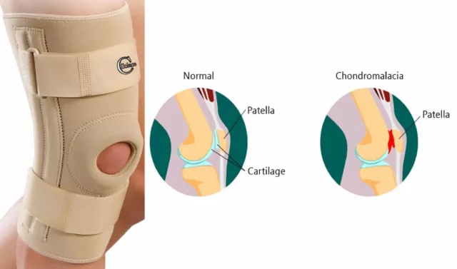 Rodillera con estabilizadores laterales y almohadillas de rótula para estabilizador de rodilla de soporte de rodilla