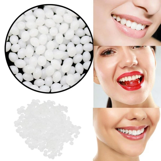 Kit riparazione denti temporanea granuli raccordo denti 2K8 G3D2 riutilizzabile T1Y9