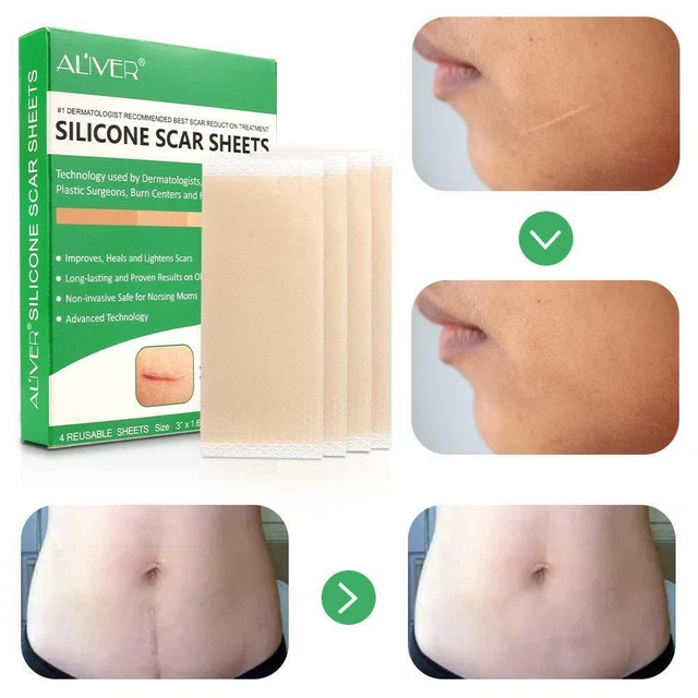 ALIVER Silicone Gel Strips Patch Scar Away Treatment Sheet Tape Repair