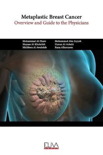 Metaplastic Breast Cancer: Overview and guide to the physicians