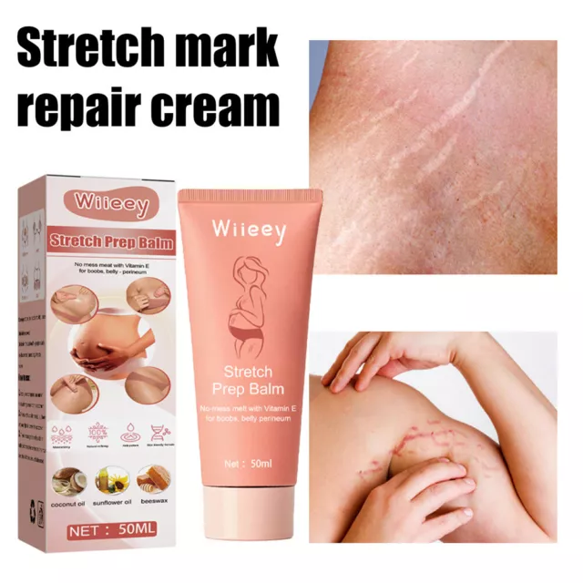 Stretch Marks Removal Repair Cream Maternity Postpartum Scar Skin Firming Cream