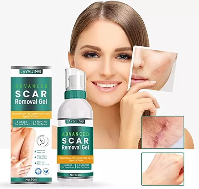 Scarremove Advanced Scar Spray for All Types of Scars, Advanced Scar Removal Gel