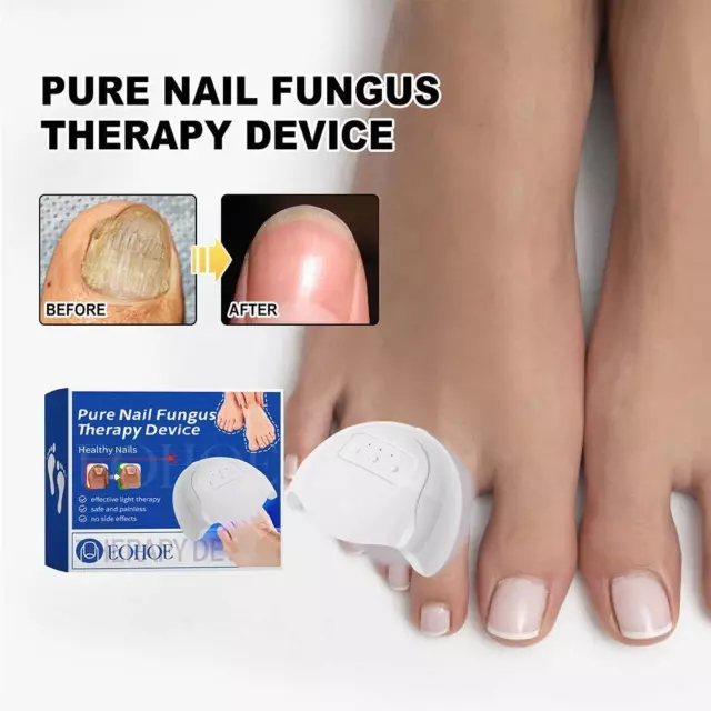 Fungal Toe Nail Device Repair Fast Toenail Nails Fungus Onychomycosis Repai H1I8