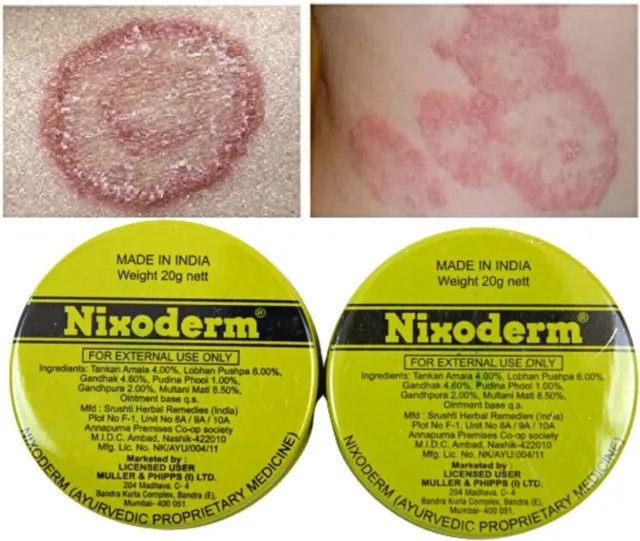 Nixoderm Crème 20 g Traiter les infections cutanées, l'eczéma, les boutons,...