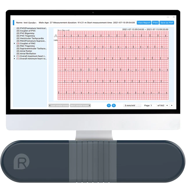 AI HR Monitor EKG Gerät | 24-Stunden Brustgurt Mit KI-Analyse | Aufladbar, Für PC-Auswertung