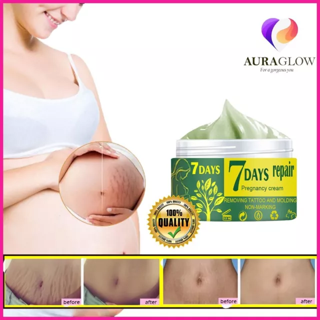 ✅ Pregnancy Scar Repair Cream Stretch Marks Removal Fat Stretch Mark Treatment