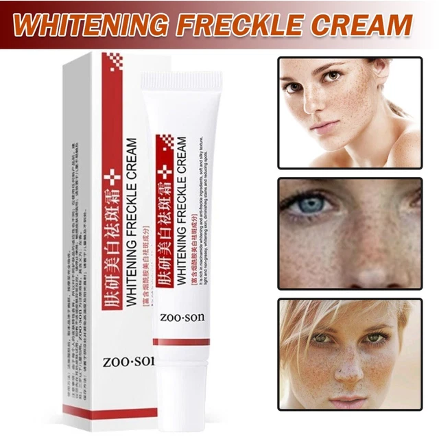 20 g crema sbiancante lentiggini rimozione macchie scure anti lentiggini G