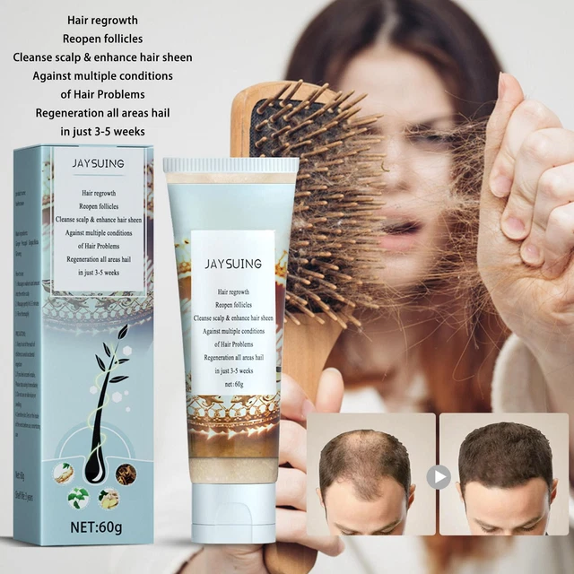 Exfoliante profesional para el crecimiento del cuero cabelludo para todo el cabello 60 g tipos H3U0