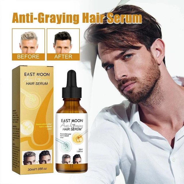 White Hair Remedies: Make these Hair Masks from Amla Powder to darken white  hair, know how to make them...