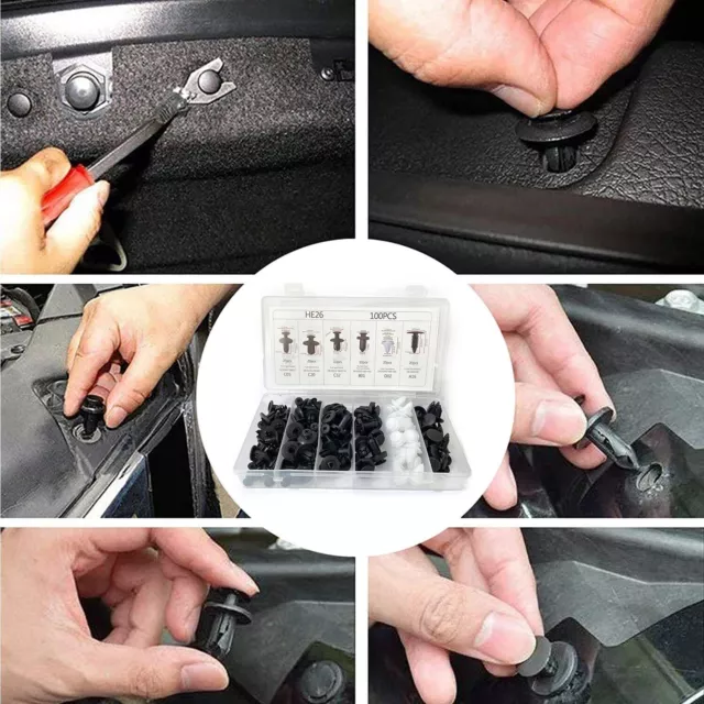 Retainer Clips Body Bumper Rivet Retainer Trim Molding Push Pin Clip Assortment