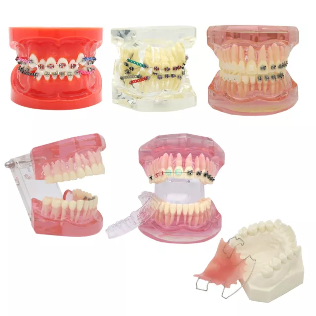 Dental Invisible Orthodontic Teeth Model Metal Ceramic Brackets Lingual Braces